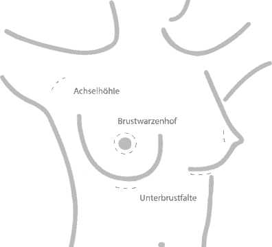 Zug Nge F R Brustimplantate Png