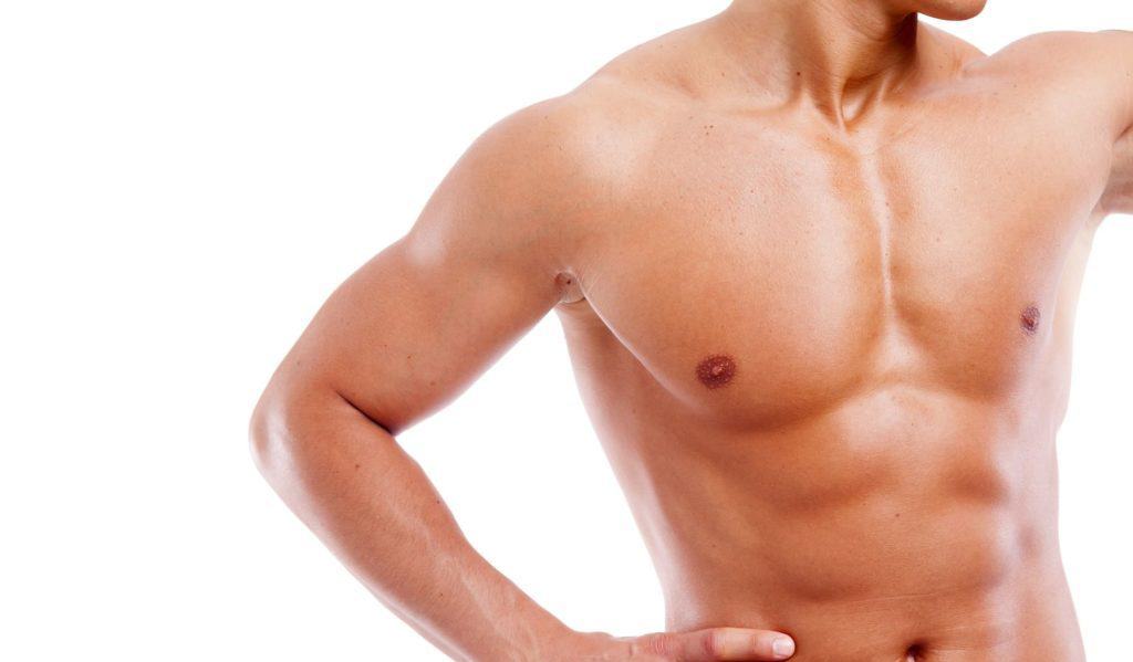 Gynaekomastie Gynaekomastie